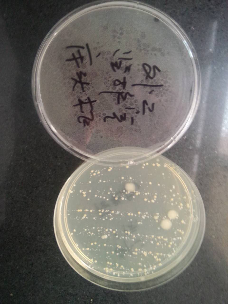 某耐药菌病人床头柜